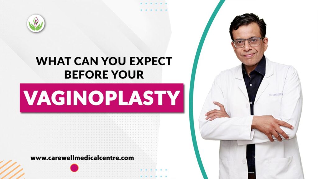 What Can You Expect Before Your Vaginoplasty Surgery,Vaginal tightening surgery in Delhi,Posterior Vaginal Repair, virgin tightening surgery side effects, Vaginoplasty procedure