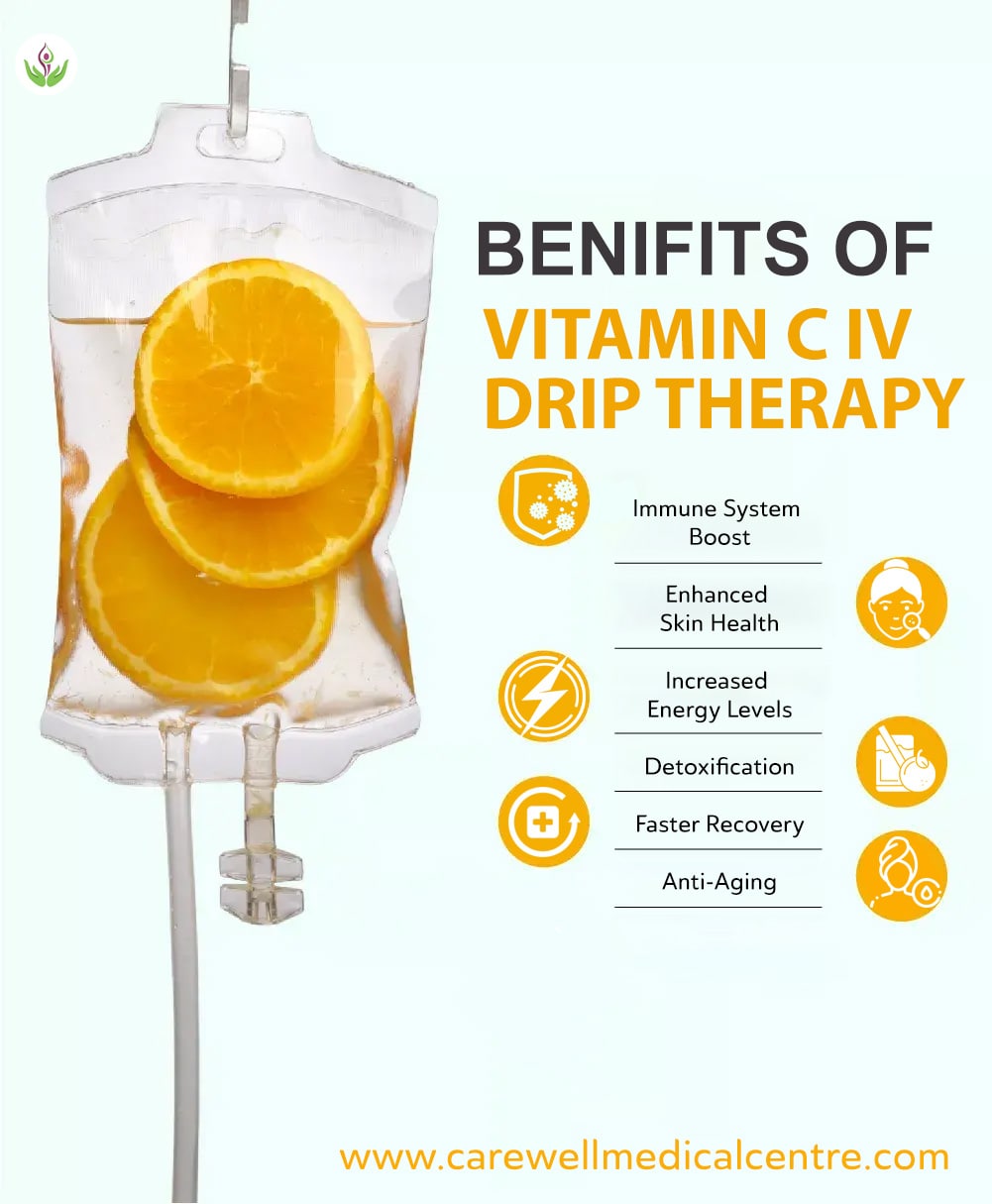 Benefits of Vitamin C IV Drip Therapy